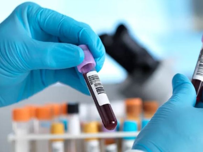 Testi i gjakut për 50 lloje kanceri emocionon shkencëtarët, mund të zbulojë sëmundjen në faza të hershme