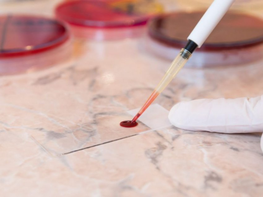 Një analizë e zakonshme gjaku zbulon edhe sëmundjet malinje