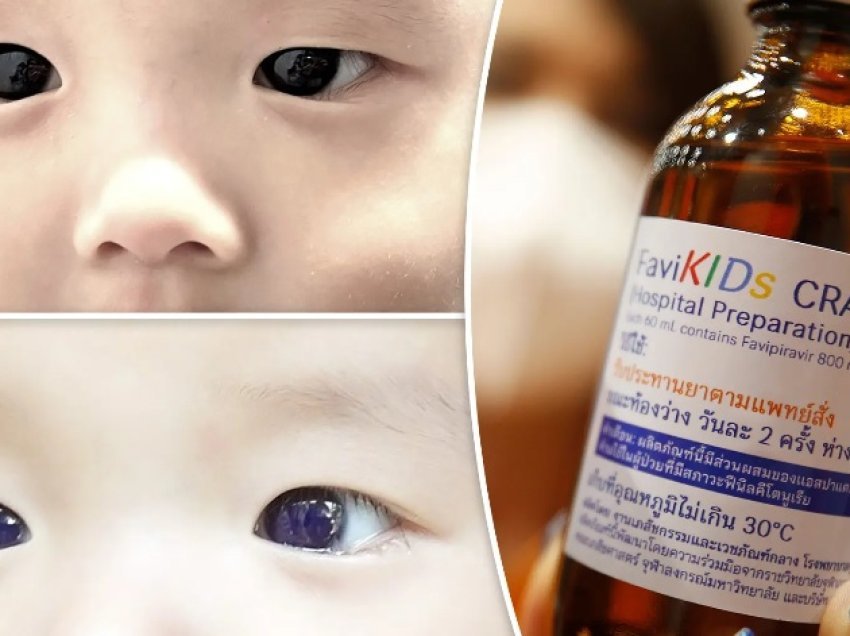 Ilaçi kundër koronavirusit “ndryshoi përkohësisht” ngjyrën e syve të një foshnje