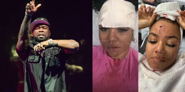 U plagos gjatë një koncerti të 50 Cent, gruaja ngre padi kundër këngëtarit: Më goditi me mikrofon, më lëndoi rëndë