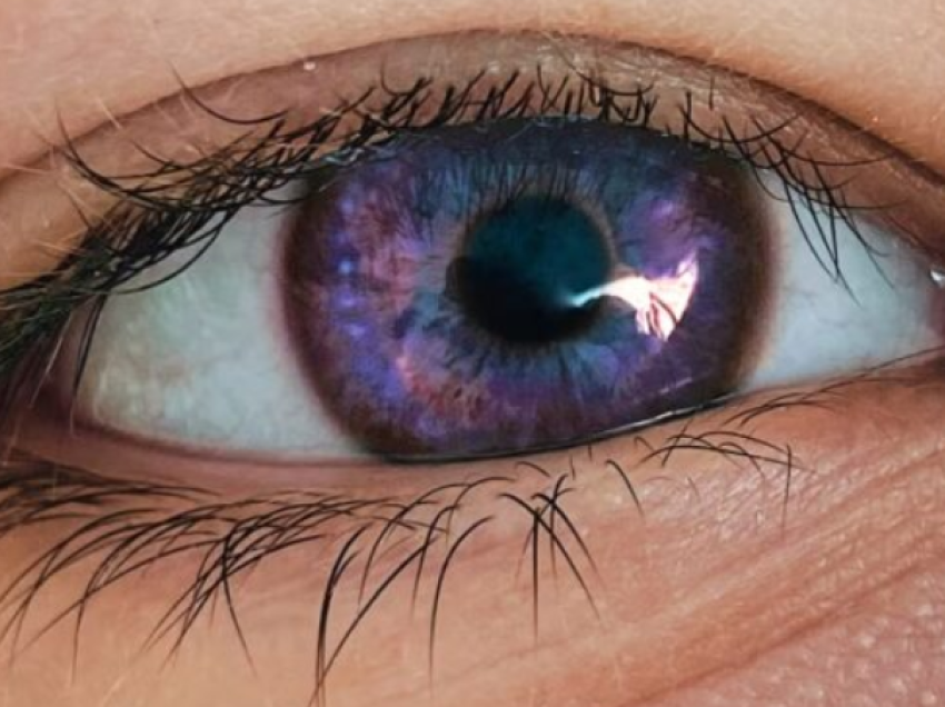 Çfarë mund të thotë ngjyra e syve për shëndetin tuaj?