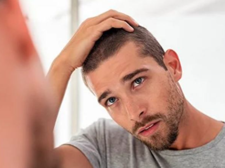 Rënia e flokëve te burrat: Çfarë e shkakton dhe si ta parandaloni