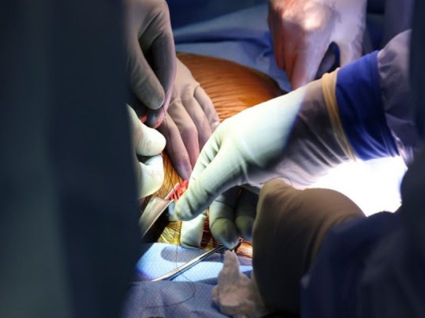 SHBA: ​Vdes pacienti dy muaj pasi mori veshkën e derrit 