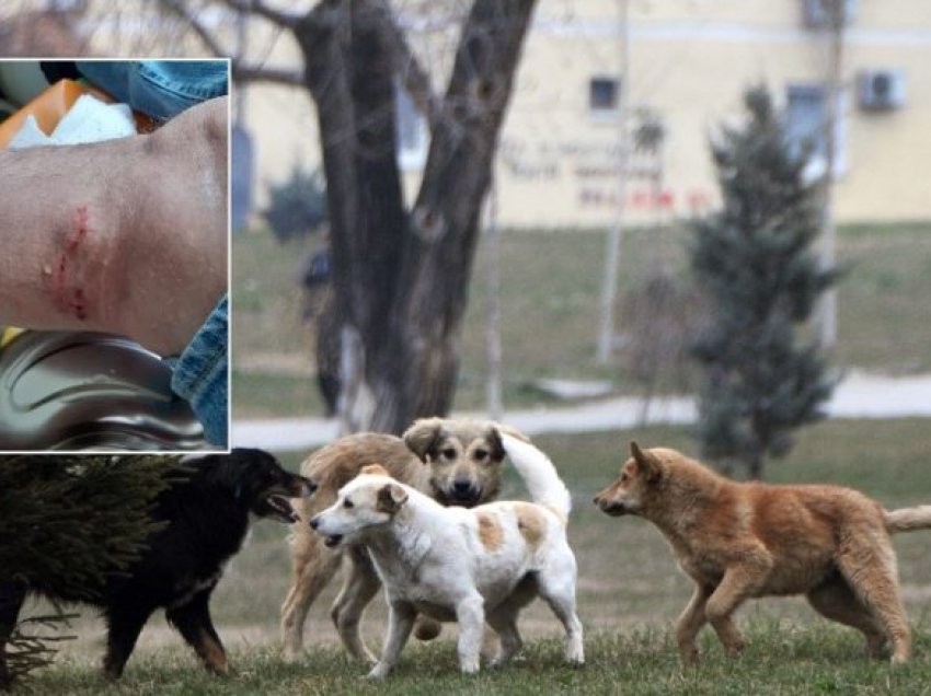 Qentë endacakë kanë kafshuar tre persona në Shkup